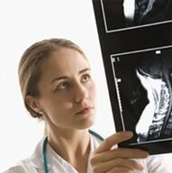 Остеохондриз диагнозу X -Ray экспертизасын колдонуу менен көрсөтүлгөн
